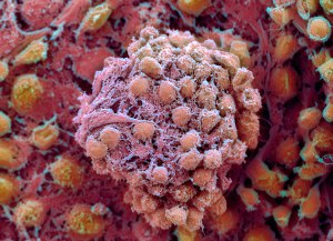 Embryonic_stem_cells