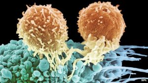 T-cells-killing-cancer